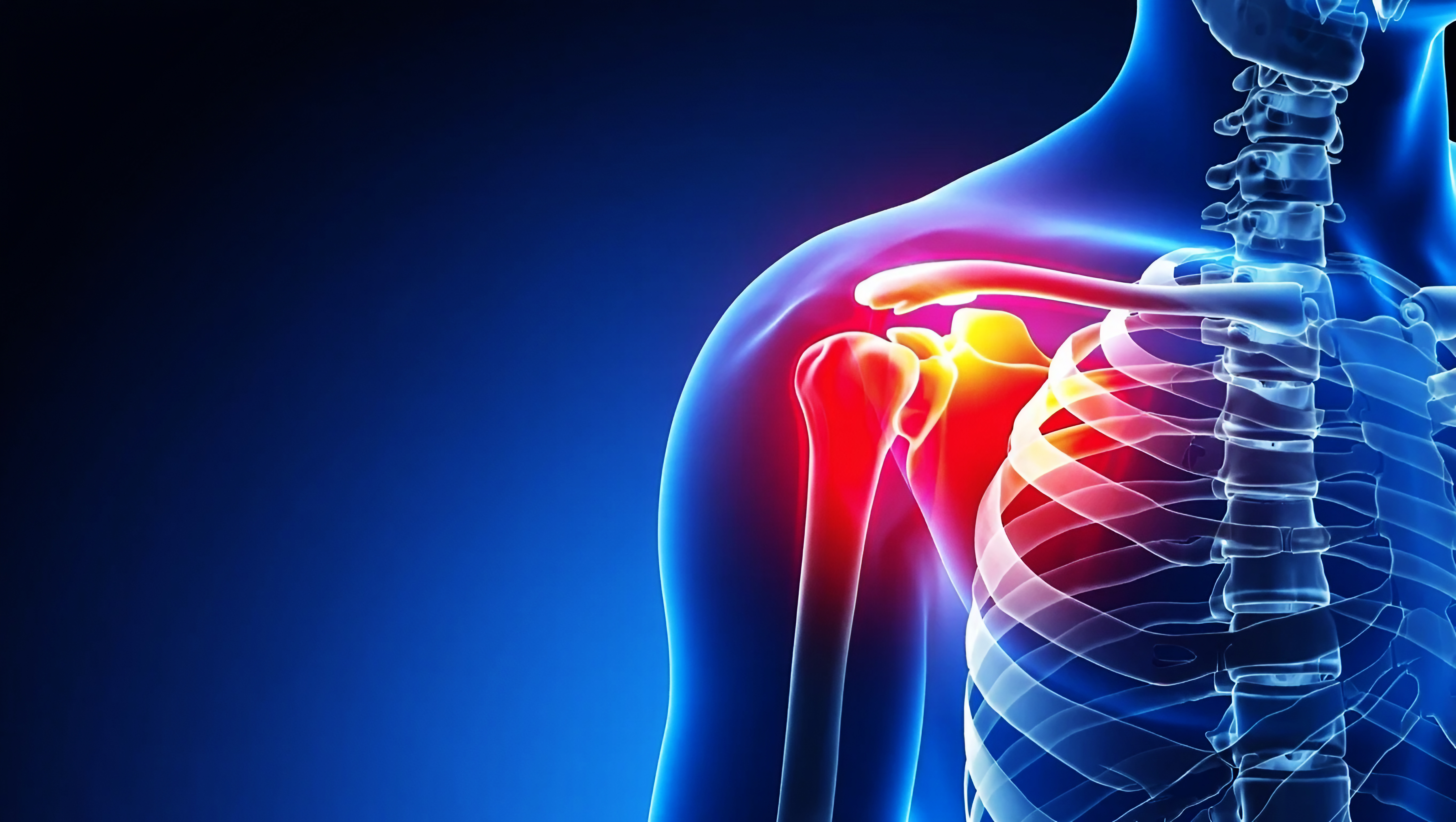 Person holding shoulder in pain — shoulder pain physical therapy Pittsburgh PA